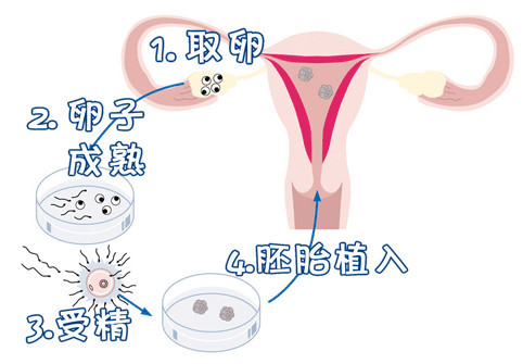 璟华生殖医学中心